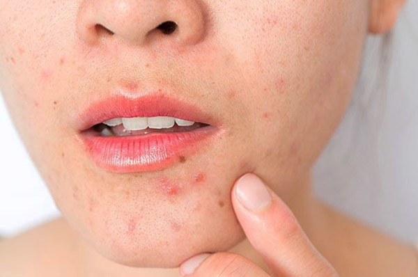 Ưu điểm nổi bật của kem nghệ dưỡng da nano bạc