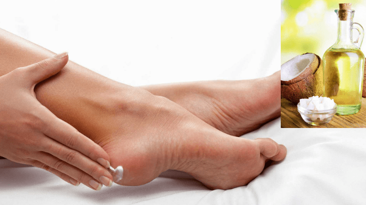 Dầu dừa trị nứt gót chân