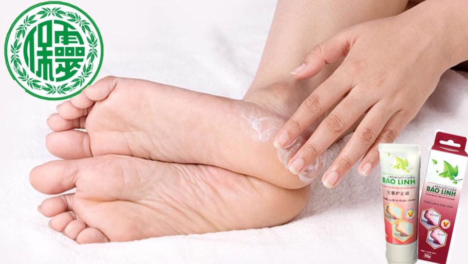 Bảo vệ bàn chân để có sức khỏe tốt cùng Bảo Linh