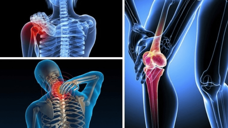 Bệnh đau nhức xương khớp: Nguyên nhân và cách điều trị