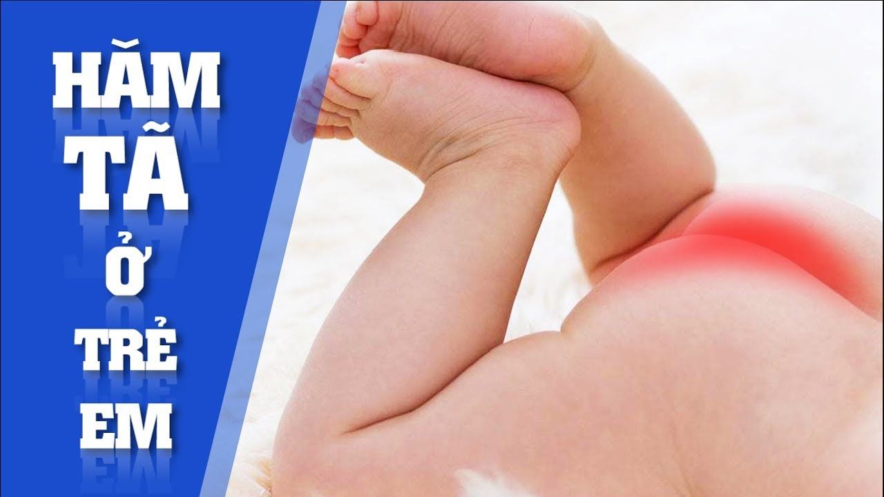 Hăm Tã ở trẻ sơ sinh