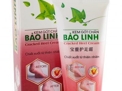 Kem dưỡng gót chân của Bảo Linh