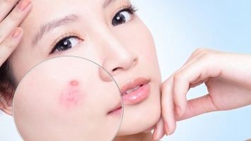 Để biết được kem nghệ giá bao nhiêu là đúng, bạn cần hiểu rõ công dụng của sản phẩm