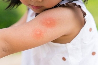 Cách đuổi muỗi trong nhà phòng sốt xuất huyết